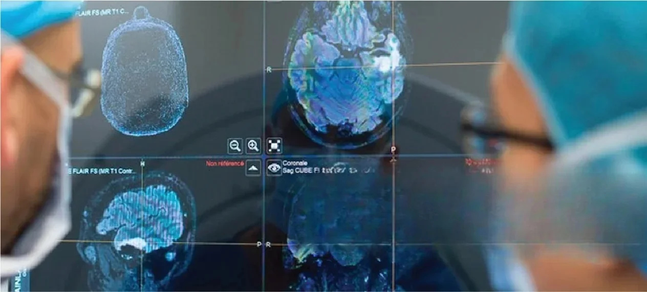 Innovative Types of Neuro-Oncology Treatment in Udaipur